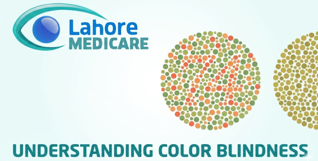 Learn why color blindness happens, the role of retinal cones, and how it affects 8% of men. Discover the causes, symptoms, and management of color vision deficiency.