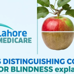 Learn why some people can't distinguish between colors, the role of retinal cones, and how genetics affects color blindness. Expert insights from Lahore Medicare.