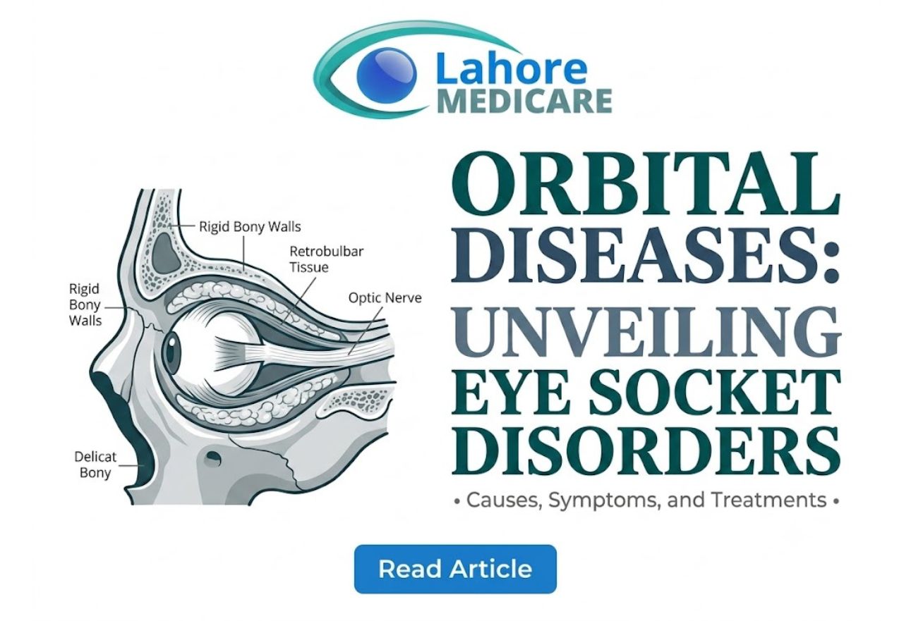 Learn about orbital cavity diseases, including Graves' disease, cellulitis, and eye socket tumors. Explore symptoms like bulging eyes and expert treatments.