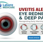 Learn to recognize the early warning signs of uveitis, including deep eye pain and redness, its causes, and modern eye inflammation treatments at Lahore Medicare.