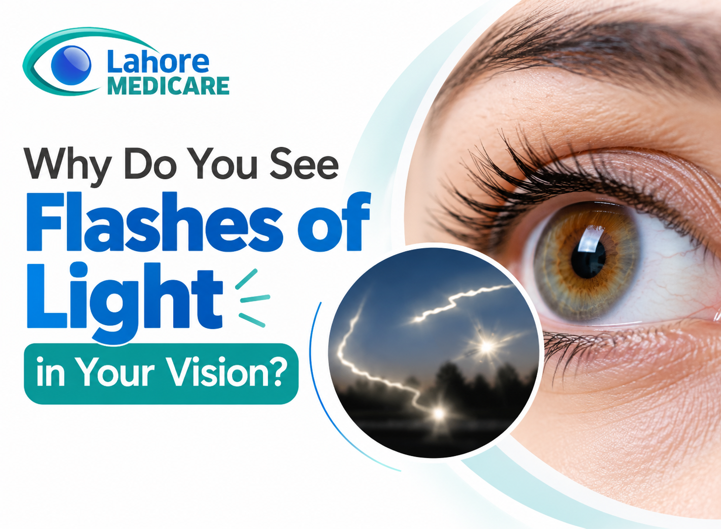 Learn why you see flashes of light in your vision, understand vitreous detachment vs retinal tears, and know when to seek care at Lahore Medicare.