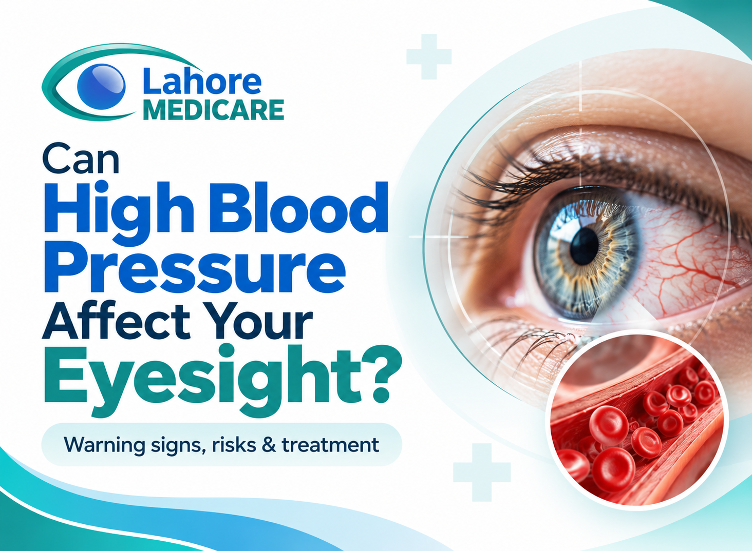 Can High Blood Pressure Affect Your Eyesight? Causes & Signs